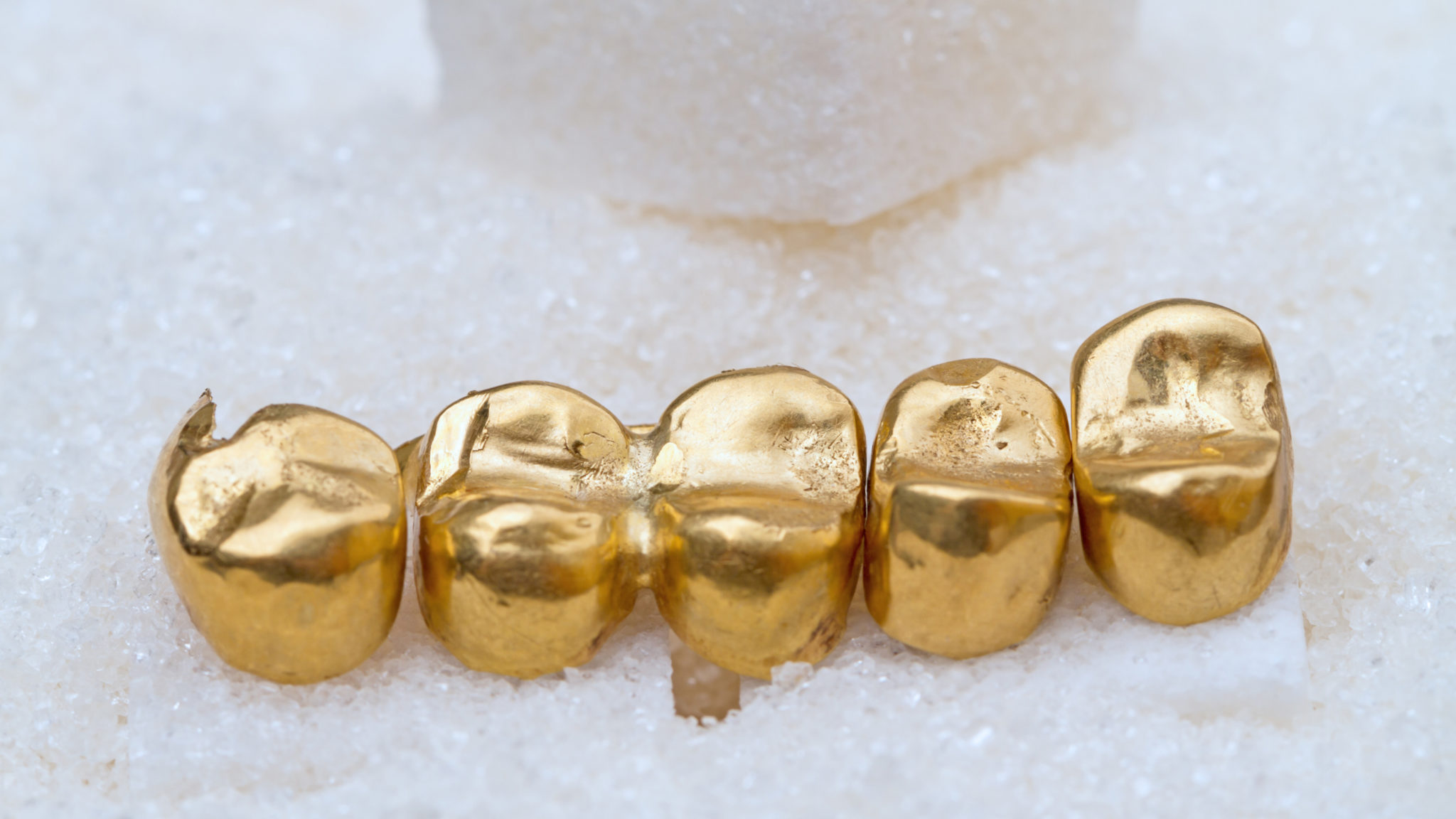 Zahngold Ankauf - Juwelier Artuk in Landshut